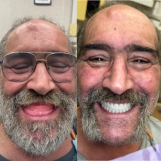 Before and after smile transformation 9